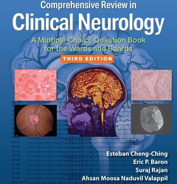 Comprehensive Review in Clinical Neurology